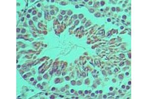 anti-Interferon Activated Gene 204 (Ifi204) (AA 70-120) antibody