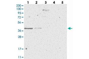 Western blot analysis of Lane 1: RT-4, Lane 2: U-251 MG, Lane 3: Human Plasma, Lane 4: Liver, Lane 5: Tonsil with SLC35A5 polyclonal antibody .
