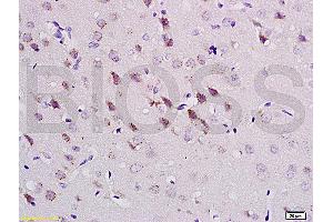 Formalin-fixed and paraffin embedded rat brain tissue labeled with Anti-CaMK2a Polyclonal Antibody (ABIN670176), Unconjugatedat 1:200, followed by conjugation to the secondary antibody and DAB staining (CAMK2A anticorps  (AA 401-478))