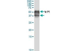 Immunoprecipitation of BCAT2 transfected lysate using anti-BCAT2 MaxPab rabbit polyclonal antibody and Protein A Magnetic Bead , and immunoblotted with BCAT2 MaxPab rabbit polyclonal antibody (D01) .