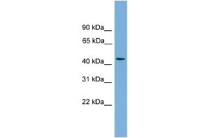 WB Suggested Anti-ZNF620 Antibody Titration: 0. (ZNF620 anticorps  (N-Term))