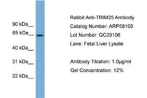 WB Suggested Anti-TRIM25  Antibody Titration: 0.