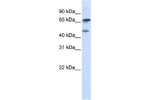 WB Suggested Anti-FOXP4 Antibody Titration:  0. (FOXP4 anticorps  (N-Term))