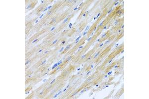 Immunohistochemistry of paraffin-embedded rat heart using CCL17 antibody (ABIN5971483) at dilution of 1/100 (40x lens). (CCL17 anticorps)