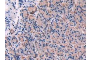 Detection of CAPN1 in Rat Tissue using Polyclonal Antibody to Calpain 1 (CAPN1)