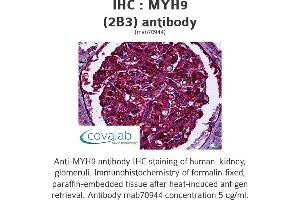 Image no. 1 for anti-Myosin 9 (MYH9) antibody (ABIN1723793) (Myosin 9 anticorps)