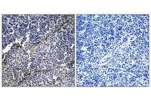 Immunohistochemistry (IHC) image for anti-Collagen, Type XIX, alpha 1 (COL19A1) (Internal Region) antibody (ABIN1850312)
