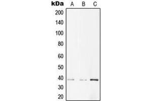 Western blot analysis of AMPK beta 1 (pS182) expression in A431 (A), NIH3T3 (B), PC12 (C) whole cell lysates. (PRKAB1 anticorps  (pSer182))