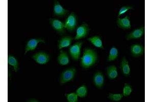 Immunofluorescence staining of A549 cells with ABIN7145298 at 1:50, counter-stained with DAPI.