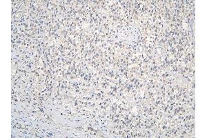 IHC analysis of CCDC36 using anti-CCDC36 antibody (ABIN6719645). (CCDC36 anticorps  (AA 172-472))