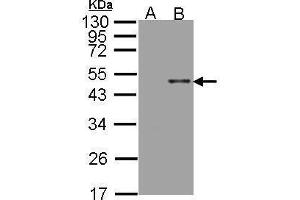WB Image Western Blot analysis of ARSB expression in transfected 293T cell line by ARSB polyclonal antibody. (Arylsulfatase B anticorps)