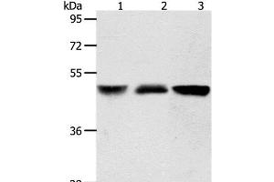 Western Blot analysis of Human brain malignant glioma and Human fetal kidney tissue, A172 cell using ACOT9 Polyclonal Antibody at dilution of 1:600 (ACOT9 anticorps)