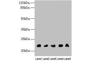 Western blot All lanes: NRSN1 antibody at 3 μg/mL Lane 1: Mouse stomach tissue Lane 2: Mouse kidney tissue Lane 3: Mouse thymus tissue Lane 4: Hela whole cell lysate Lane 5: 293T whole cell lysate Secondary Goat polyclonal to rabbit IgG at 1/10000 dilution Predicted band size: 22 kDa Observed band size: 22 kDa (Neurensin 1 anticorps  (AA 1-65))