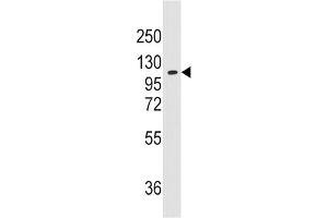 Western Blotting (WB) image for anti-Alanyl-tRNA Synthetase 2, Mitochondrial (AARS2) antibody (ABIN3003290) (AARS2 anticorps)