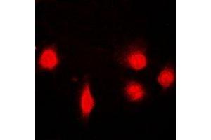 Immunofluorescent analysis of SH2B1 staining in U2OS cells. (SH2B1 anticorps)