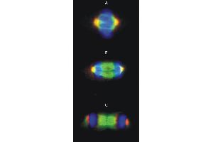 Immunocytochemistry staining of microtubular networks in 3T3 mouse fibroblasts.