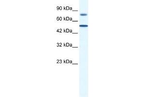 WB Suggested Anti-ZNF223 Antibody Titration:  0. (ZNF223 anticorps  (N-Term))