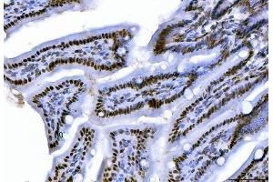 IHC analysis of CTBP2 using anti-CTBP2 antibody (ABIN7601326). (CTBP2 anticorps  (AA 321-445))