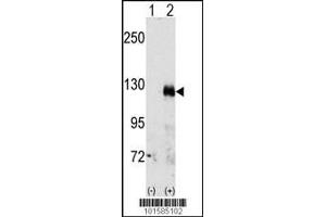 Western blot analysis of EphA3 using rabbit polyclonal EphA3 Antibody. (EPH Receptor A3 anticorps  (C-Term))