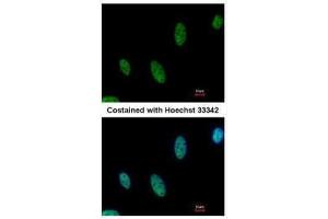 ICC/IF Image Immunofluorescence analysis of paraformaldehyde-fixed HeLa, using AF9, antibody at 1:500 dilution.