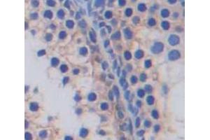 Used in DAB staining on fromalin fixed paraffin- embedded Kidney tissue (SLC2A14 anticorps  (AA 1-105))