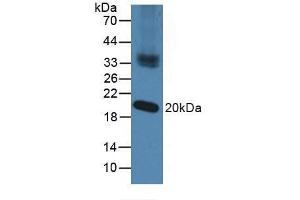 Detection of NXN in Mouse Testis Tissue using Polyclonal Antibody to Nucleoredoxin (NXN) (NXN anticorps  (AA 166-327))