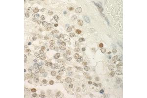 Immunohistochemistry (IHC) image for anti-Papillary Renal Cell Carcinoma (Translocation-Associated) (PRCC) (AA 125-175) antibody (ABIN7448740)