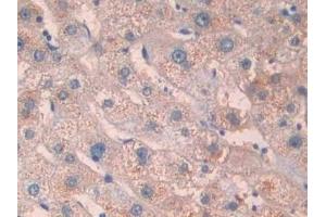 Detection of IL1R1 in Human Liver Tissue using Polyclonal Antibody to Interleukin 1 Receptor Type I (IL1R1)