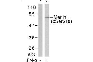 Western blot analysis of extracts from HUVEC cells untreated(lane 1) or treated with IFN-a(lane 2) using Merlin(Phospho-Ser518) Antibody. (Merlin anticorps  (pSer518))