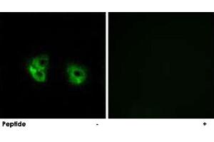 Immunofluorescence analysis of A-549 cells, using MARCH2 polyclonal antibody . (MARCH2 anticorps)