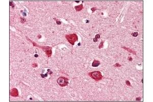 Immunohistochemistry (IHC) image for anti-Podoplanin (PDPN) (AA 1-206), (N-Term) antibody (ABIN302234)