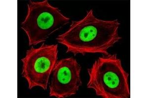 Fluorescent image of MCF-7 cells stained with Cdk4 antibody.