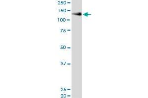 Immunoprecipitation of NCAM1 transfected lysate using anti-NCAM1 MaxPab rabbit polyclonal antibody and Protein A Magnetic Bead , and immunoblotted with NCAM1 MaxPab mouse polyclonal antibody (B01) .