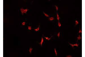 ABIN6266882 staining A-431 cells by IF/ICC. (DNAJB1 anticorps  (C-Term))