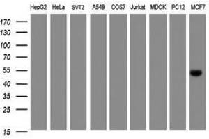 Image no. 1 for anti-Selenium Binding Protein 1 (SELENBP1) antibody (ABIN1500862) (SELENBP1 anticorps)