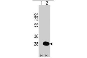 Western blot analysis of HSPB1 (arrow) using HSPB1 polyclonal antibody . (HSP27 anticorps  (Ser83))