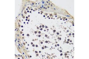 Immunohistochemistry of paraffin-embedded rat testis using CCDC59 antibody (ABIN7266440) at dilution of 1:100 (40x lens).