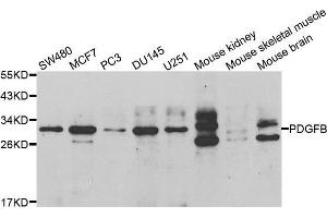 Western blot analysis of extracts of various cell lines, using PDGFB antibody. (PDGFB anticorps  (AA 20-241))