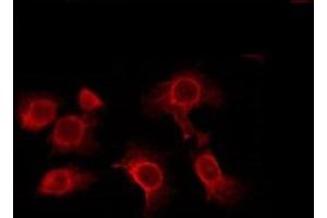 ABIN6276005 staining RAW264. (ADGRF4 (C-Term) anticorps)