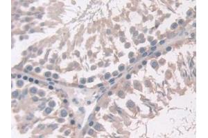 Detection of ADIPOR2 in Rat Testis Tissue using Polyclonal Antibody to Adiponectin Receptor 2 (ADIPOR2)