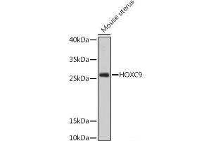 Western blot analysis of extracts of Mouse uterus using HOXC9 Polyclonal Antibody at dilution of 1:1000. (HOXC9 anticorps)