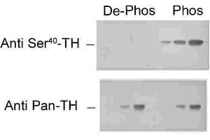 Immunohistochemical staining of retina with the pan-tyrosine hydroxylase (pan-TH) and phospho-specific tyrosine hydroxylase (phospho-TH) antibodies. (Tyrosine Hydroxylase anticorps  (pSer40))