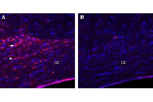 anti-Lysophosphatidic Acid Receptor 1 (LPAR1) (AA 36-50), (Extracellular) antibody