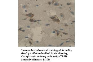 Image no. 1 for anti-ATP Synthase, H+ Transporting, Mitochondrial F1 Complex, beta Polypeptide (ATP5B) antibody (ABIN1574891)