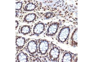 Immunohistochemistry of paraffin-embedded human colon using Histone H4 Rabbit mAb (ABIN7267706) at dilution of 1:100 (40x lens). (HIST4H4 anticorps)
