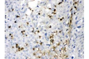 IHC analysis of CA2 using anti- CA2 antibody .