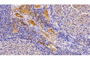 Detection of LEP in Rat Ovary Tissue using Polyclonal Antibody to Leptin (LEP)