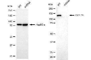 Western blotting analysis using CYFIP1 antibody (ABIN7798263). (CYFIP1 anticorps)