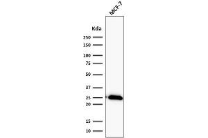 Western Blot Analysis of human MCF-7 cell lysate using Bcl-2 Rabbit Recombinant Monoclonal Antibody (BCL2/2210R).