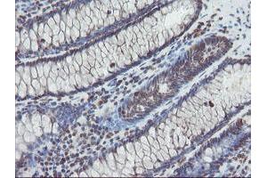 Image no. 7 for anti-Tryptophan 2,3-Dioxygenase (TDO2) antibody (ABIN1501352)